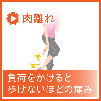 肉離れ