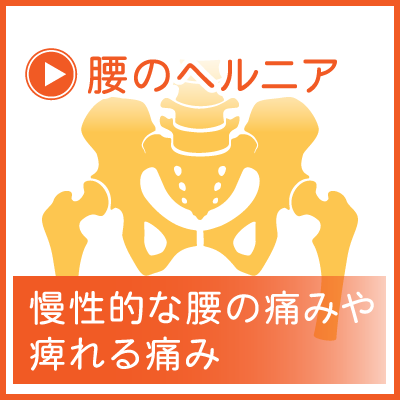 腰のヘルニア